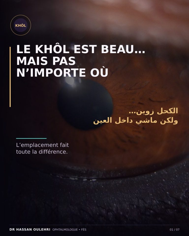 Khôl traditionnel et santé des yeux : précautions et risques pour les paupières